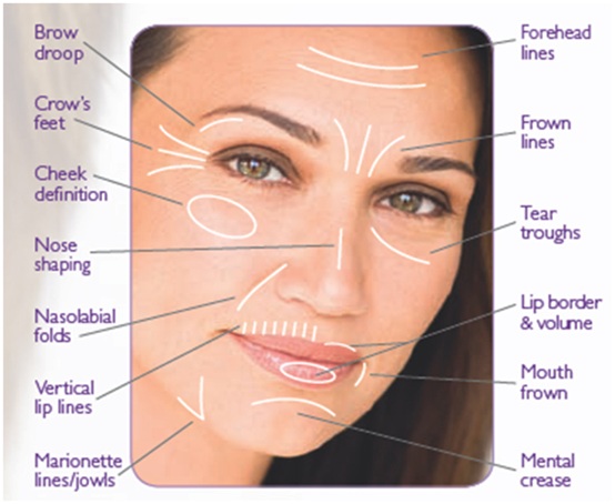 nasolabial face fillers folds dermal facial wrinkle treatment causes fold wrinkles treatments makeup lines filler cheeks india punjab lip symptoms